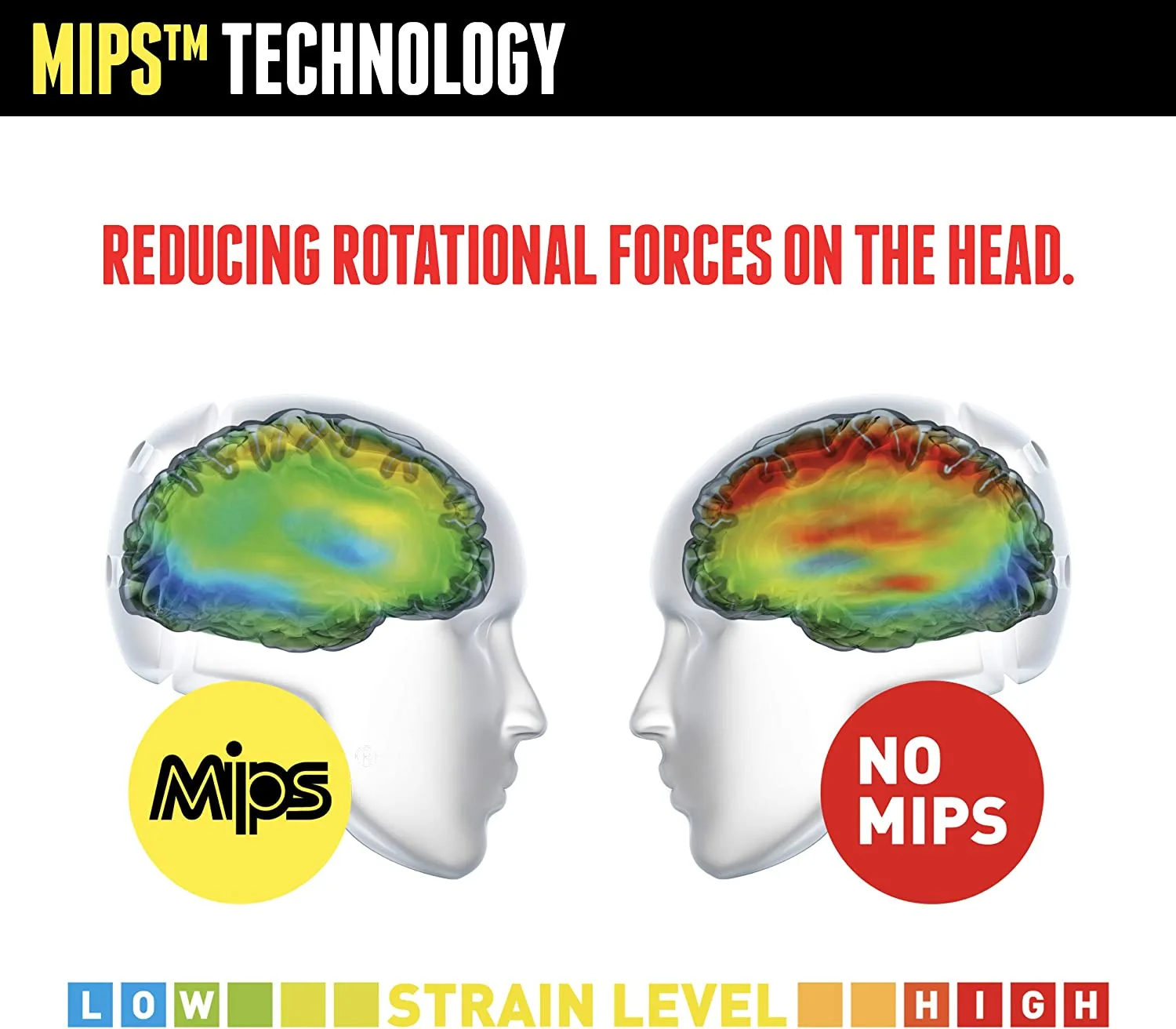 MIPS technology